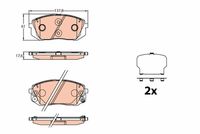 TRW GDB3640 - Lado de montaje: Eje trasero<br>Tamaño freno: 16"<br>año construcción desde: 02/2015<br>Restricción de fabricante: AKEBONO<br>Ancho [mm]: 99,8<br>Altura [mm]: 41,2<br>Espesor [mm]: 15,5<br>Contacto avisador de desgaste: con avisador acústico de desgaste<br>Homologación: E990R-01120/2689ExtI<br>