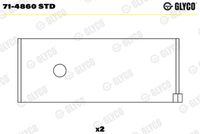 GLYCO 714860STD - Código de motor: DC 11.02<br>Nº de componente: 71-4860<br>dimensión inferior [mm]: 0,25<br>